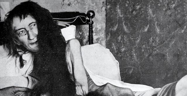 这个皮包骨的女鬼，竟是法国第一美人？1901年，法国警察在一个阁楼上，发现了一个