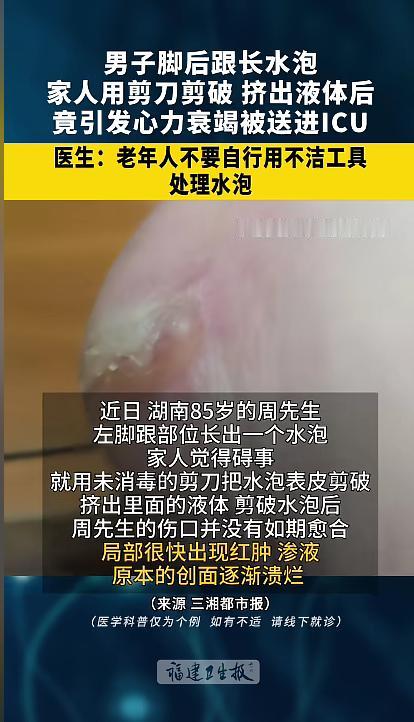 “悲剧还是发生了！”近日，一男子脚后跟起了个水泡，家里人看见后就拿剪刀给挑开了。