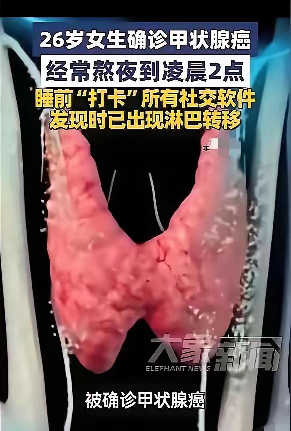 这26岁女子玩手机患癌的事儿，真是给咱们敲响了警钟！现在癌，谁不是手机不离手，