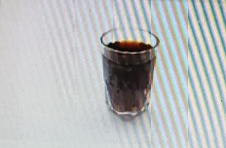 现在好多尿毒症真就是吃出来的！就说那些高盐食物，像腌肉、咸菜，很多人一顿饭没它们