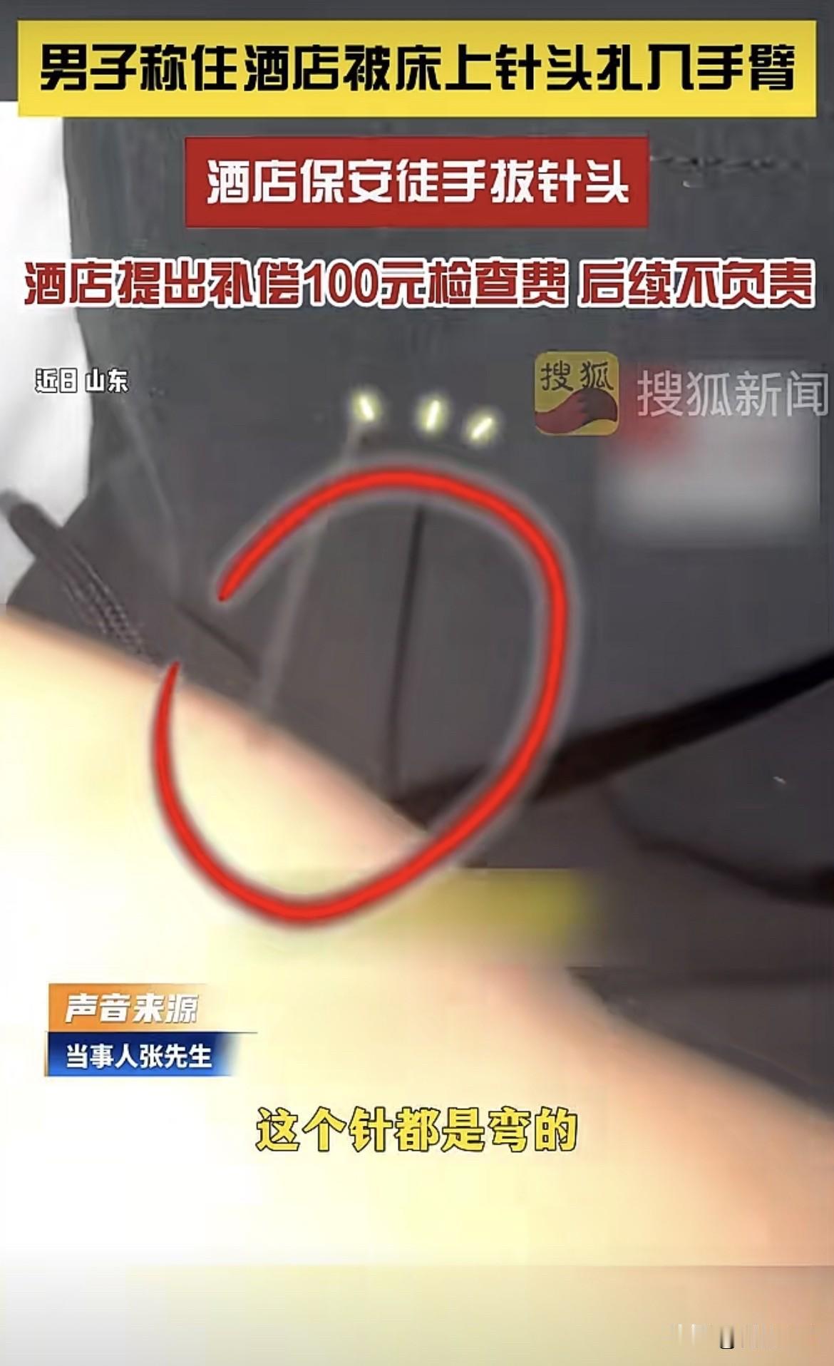 山东，男子被注射器针头扎了一下，酒店保安赶到，徒手拔出针头，既未消毒，也没送医，