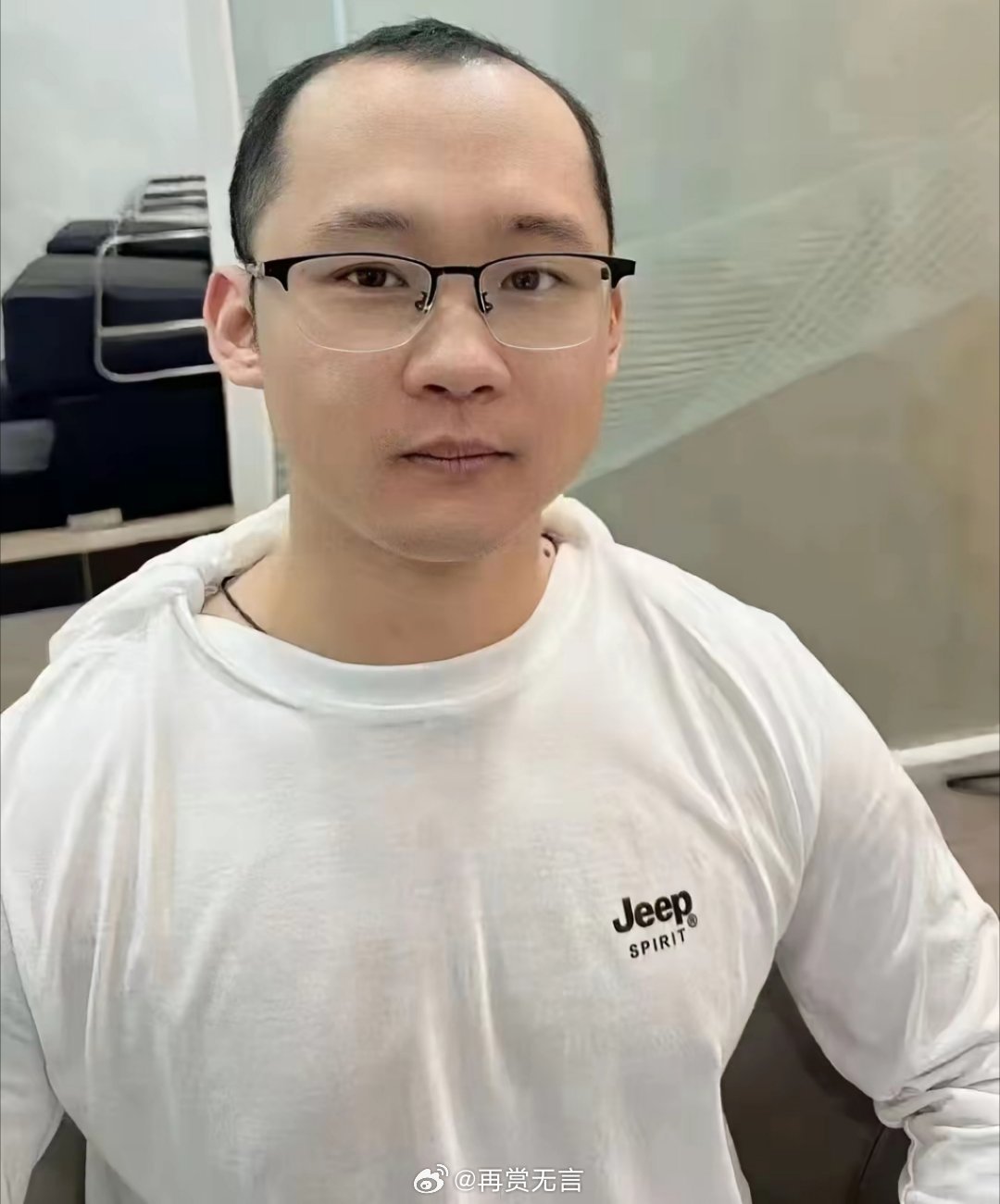 几百块的假发片翻车了！戴上像顶锅盖，假得离谱。果然专业的事还得专业的人做。