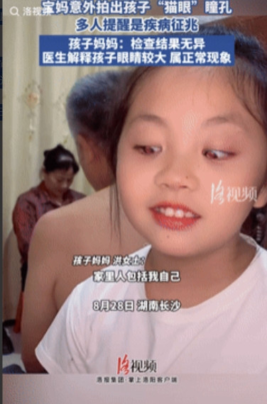 长知识了！”湖南长沙，女子闲着无聊给女儿拍照，不料却看到孩子眼睛发红像“猫眼”，