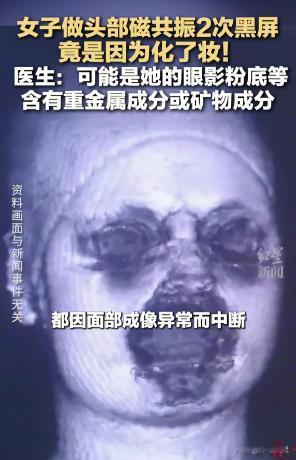 12月1日发布，福建泉州，一女子头晕去医院检查。没想到，做核磁共振时先后