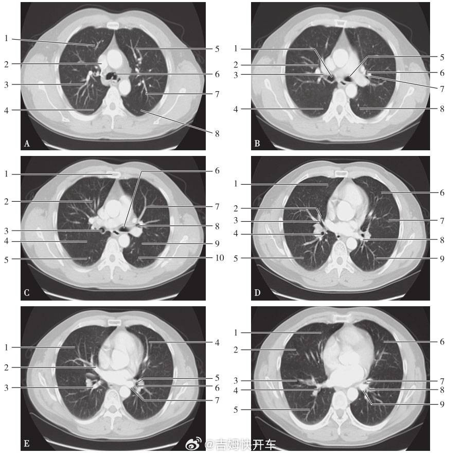 原来香蕉有辐射日常生活里能接触到的，去医院拍片是辐射最大的，其中胸部CT的辐射量