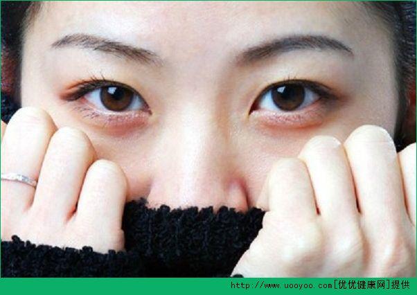 早上起床眼睛肿了怎么办? 早上眼睛肿了怎样消肿?