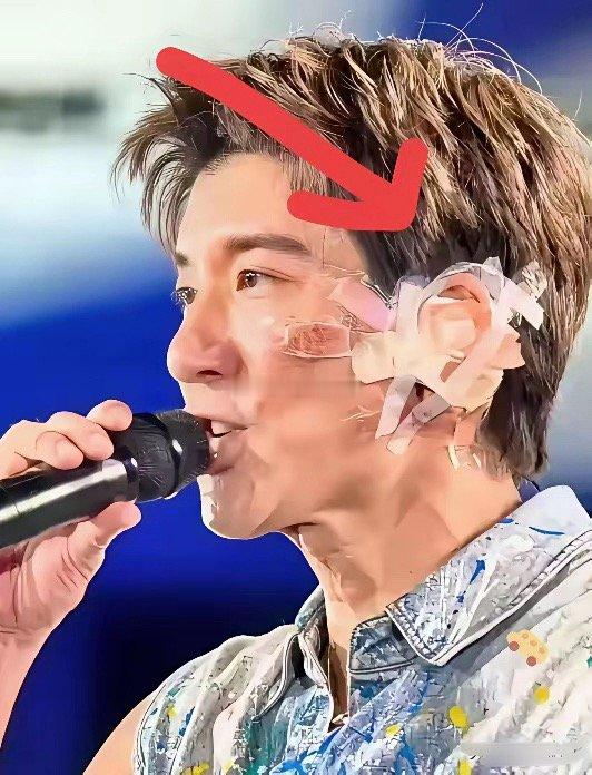 王力宏这次赚大发了，他的这次受伤预估最少值10个亿，为什么这么说？大家都知道，王
