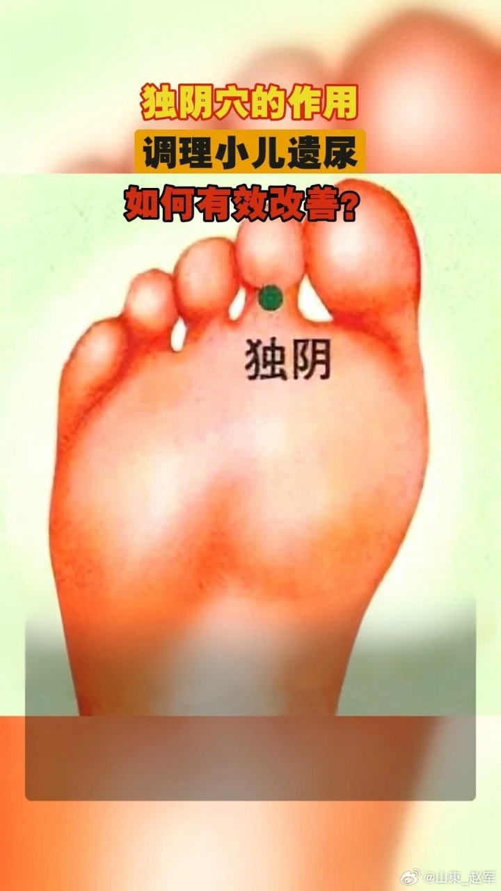 一、独阴穴（经外奇穴）-定位：足第2趾跖侧（足底）远端趾间关节横纹中点，左右各