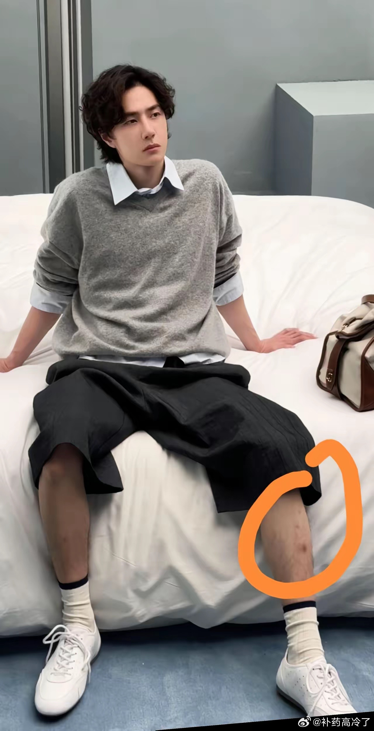 王一博的腿是受伤了吗？