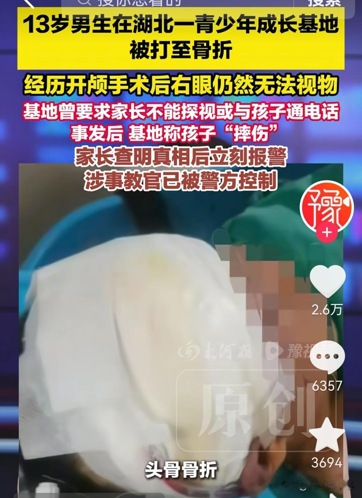 张先生怎么都没想到，自己的一番好意差点害儿子送命。江西九江张先生，花了3