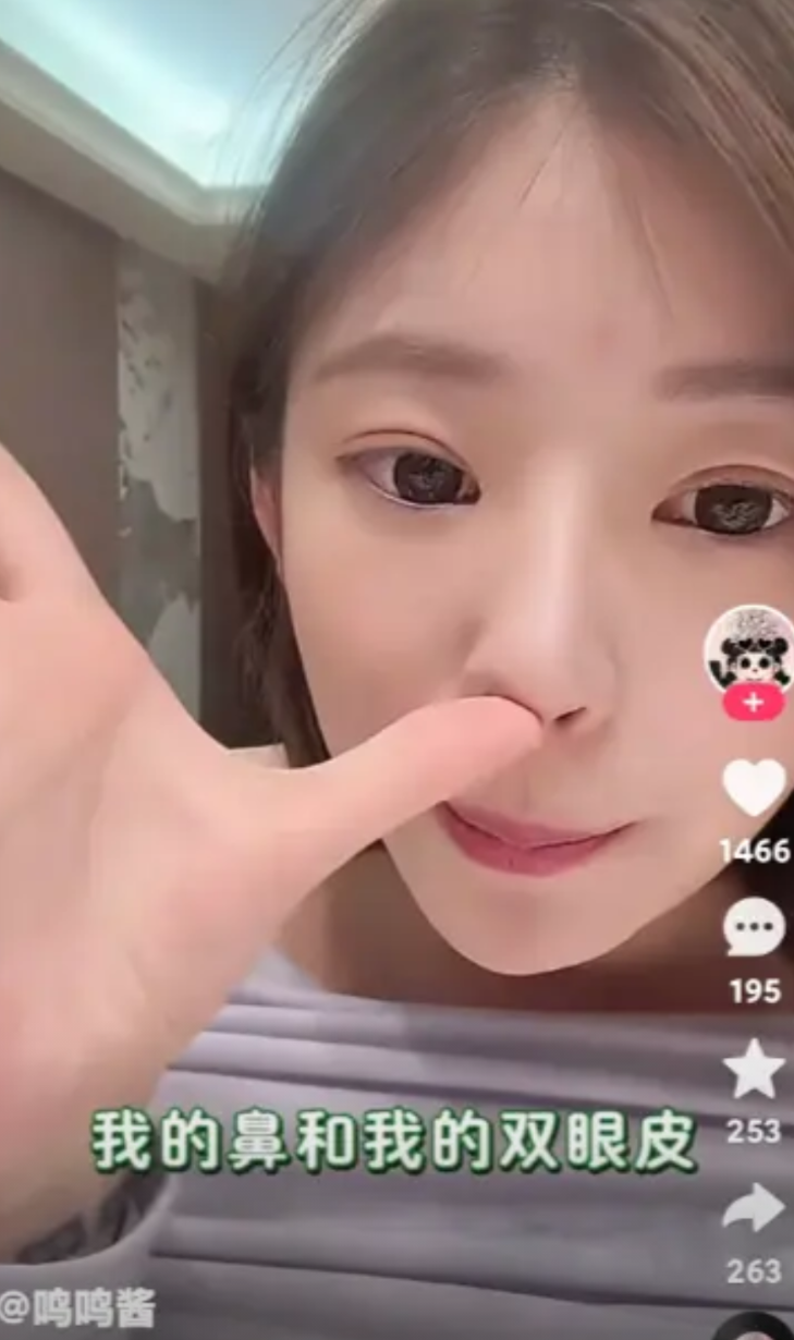 王思聪前女友黄一鸣说：“我的双眼皮拉的，我的鼻子也是做的，都是在上海九院做的！我