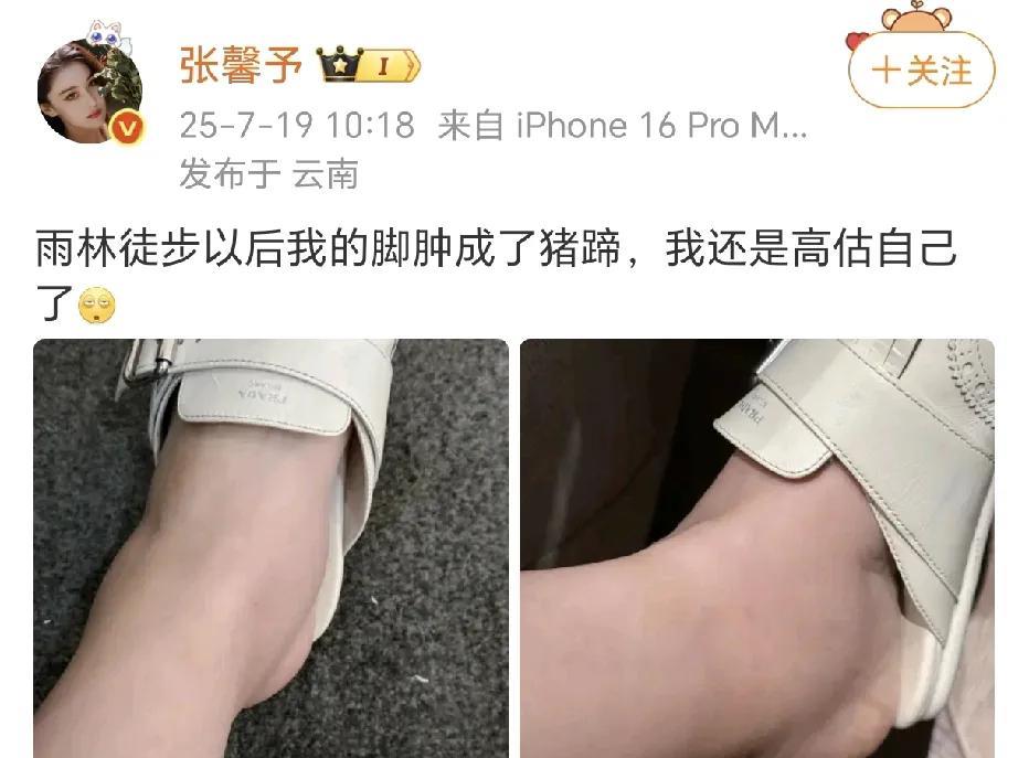 张馨予脚肿成猪蹄！张馨予和老公一起走进了大自然，她的胆子是真的大。毛毛虫直接抓