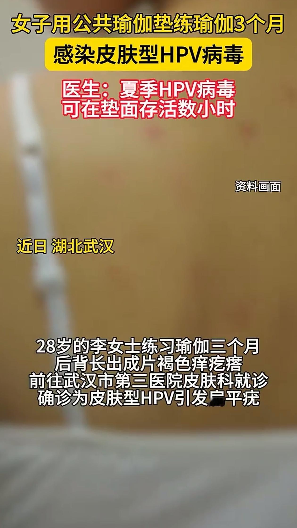 出乎意料了！湖北武汉，女子后背突然长满了密密麻麻的小红点，去医院一查竟然感染了H