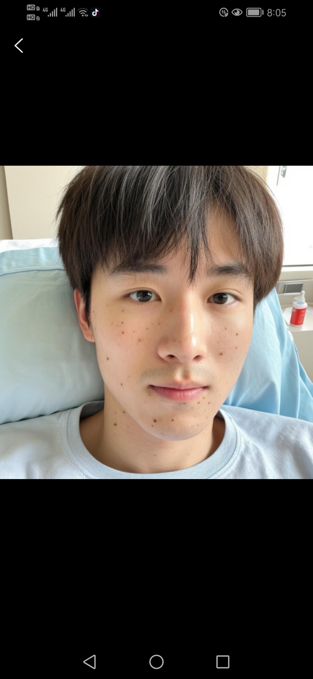 男子挤掉一颗痘痘，为何肺部会出现多个空洞？这背后隐藏着怎样的健康危机？近日，宁