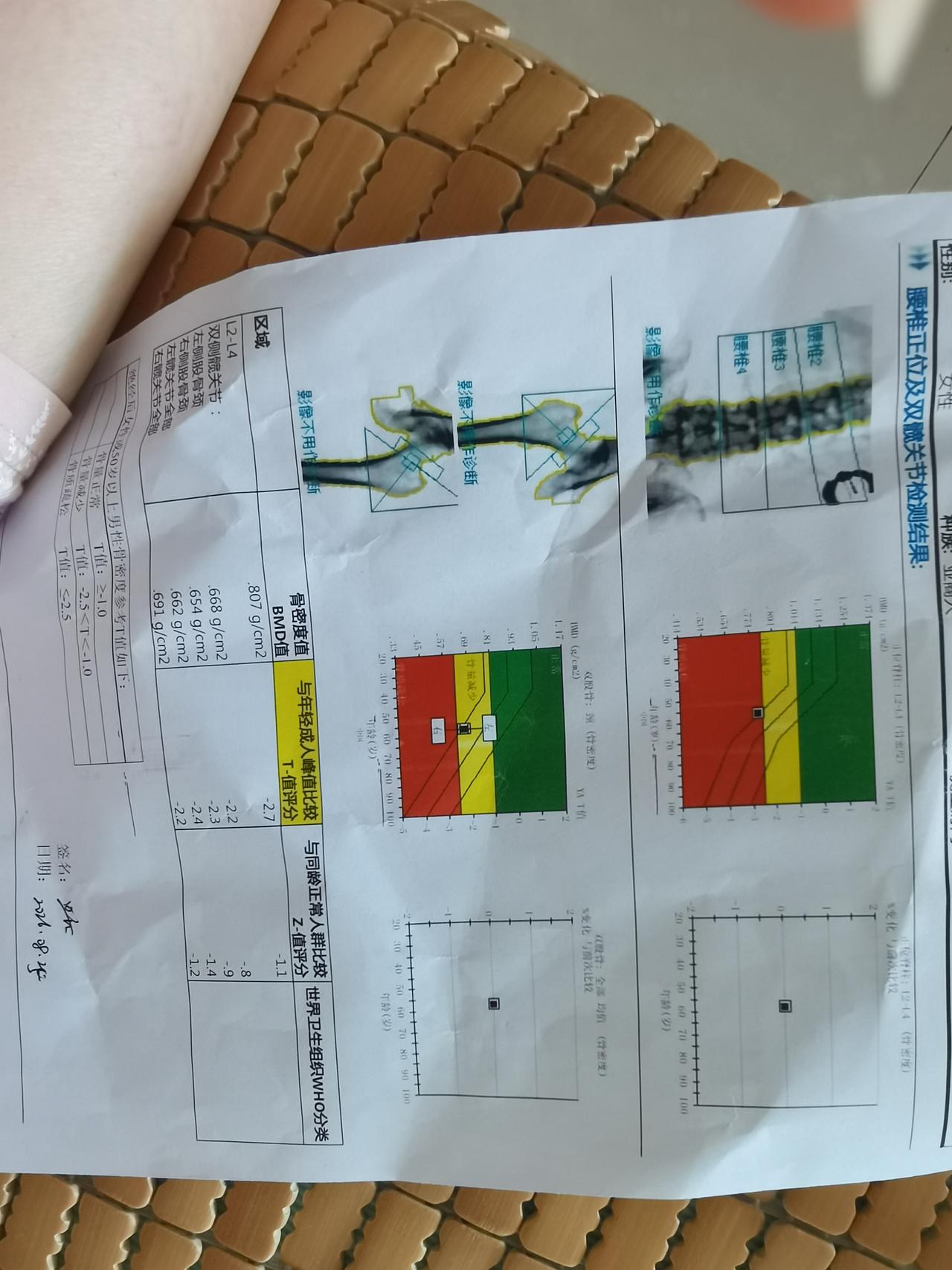 体检报告出来了，骨密度骨T值-2点6，属于骨质疏松，建议门诊进一步检查。上午挂