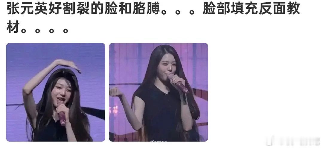 好割裂啊，脸肿肿的，手臂细细的