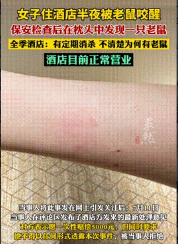 不罚不行！”江西南昌，一女子在某酒店入住，半夜时突然感到手臂很疼，结果等女子醒来
