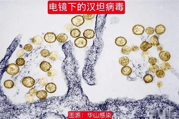 汉坦病毒从发病到死亡仅5天汉坦病毒疫情可以从四个科学角度安慰大家，不用担心汉坦