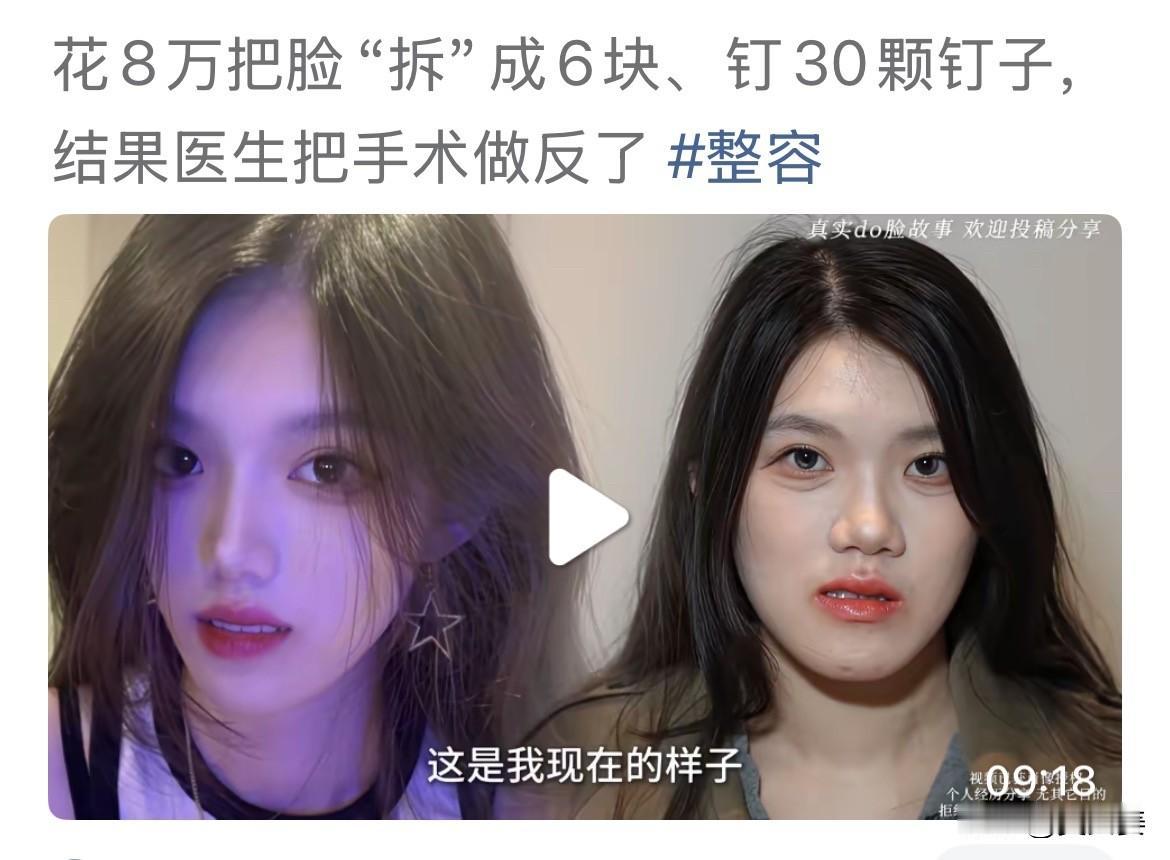 20260420整形前是个美女，整形后却变成了丑女，这放在谁身上都受不了。一