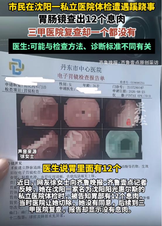 丧尽天良！8月22日辽宁沈阳，女子陪丈夫参加单位体检，顺手做了个胃肠镜。麻