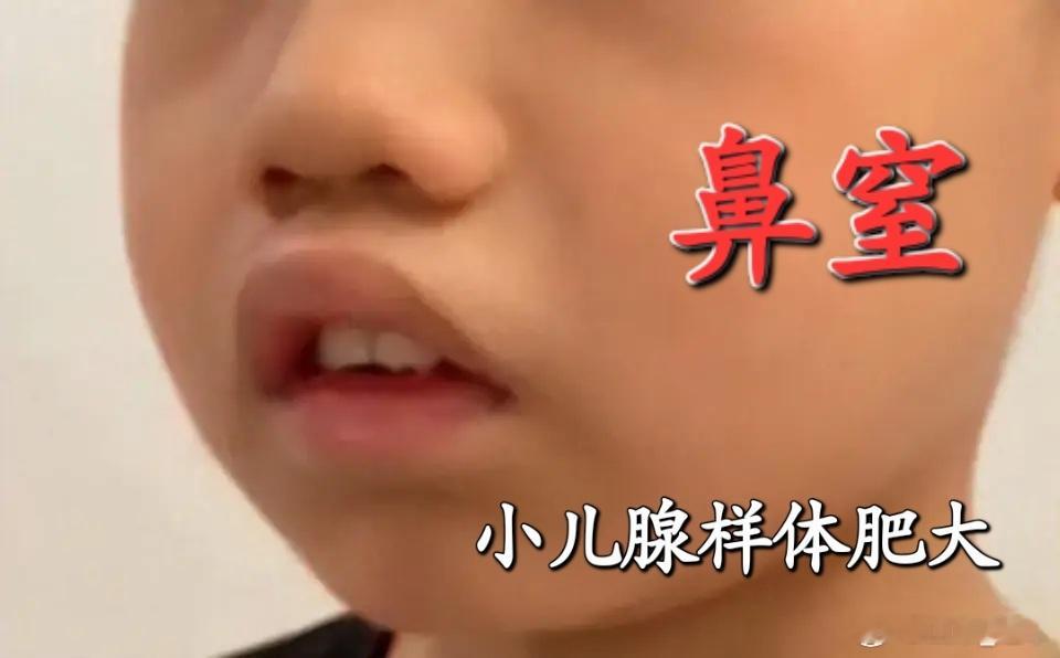 《五十二病方·鼻窒篇》残卷补遗余尝闻上古医家有言：