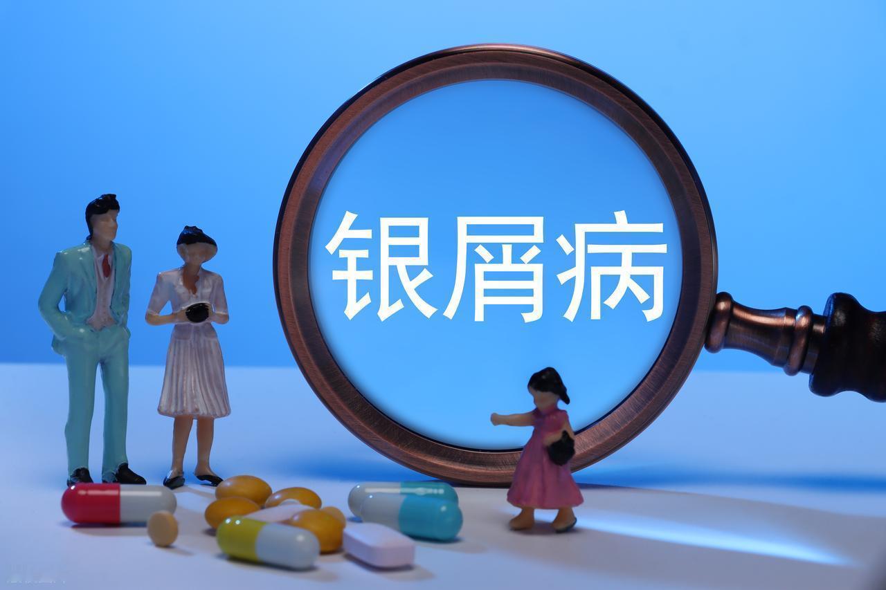 为什么银屑病会加重甚至复发呢?银屑病是一种常见的慢性炎症性皮肤病，也常被称为“