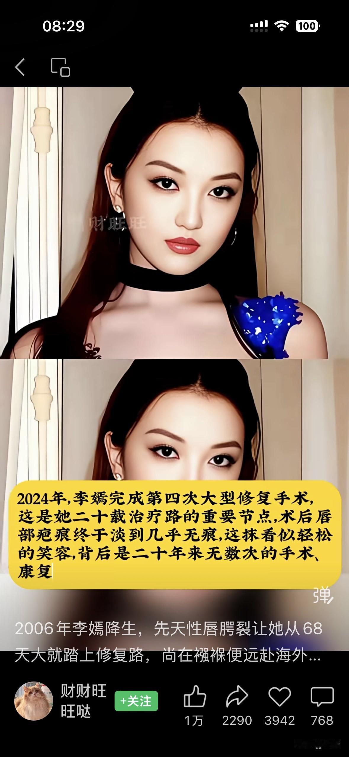 不敬佩李亚鹏，不敬佩王菲，但敬佩他们的女儿李嫣。2006年李嫣降生，先天性唇