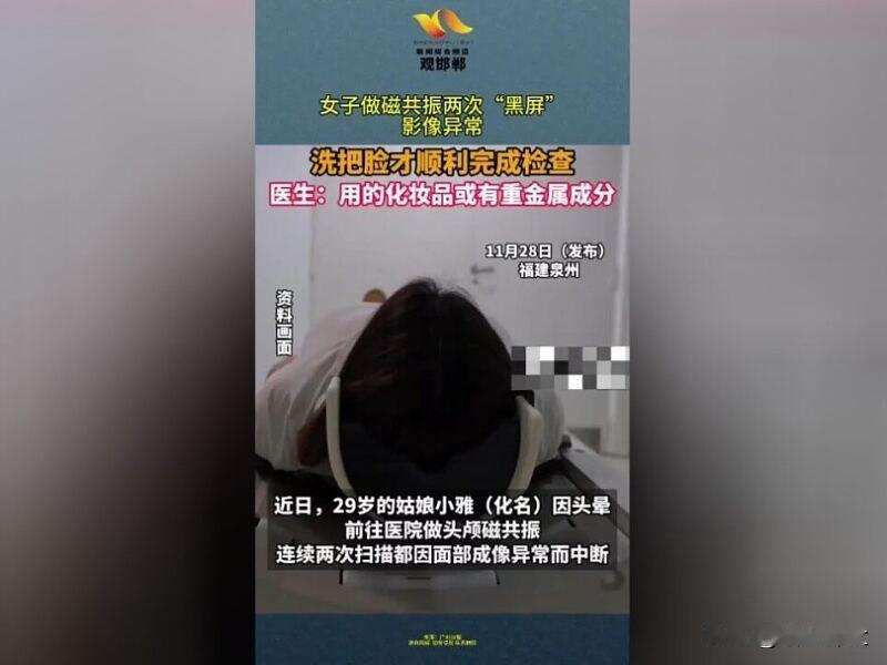 近日，29岁的泉州姑娘小雅（化名）因头晕，前往福建医科大学附属第二医院做头颅磁共