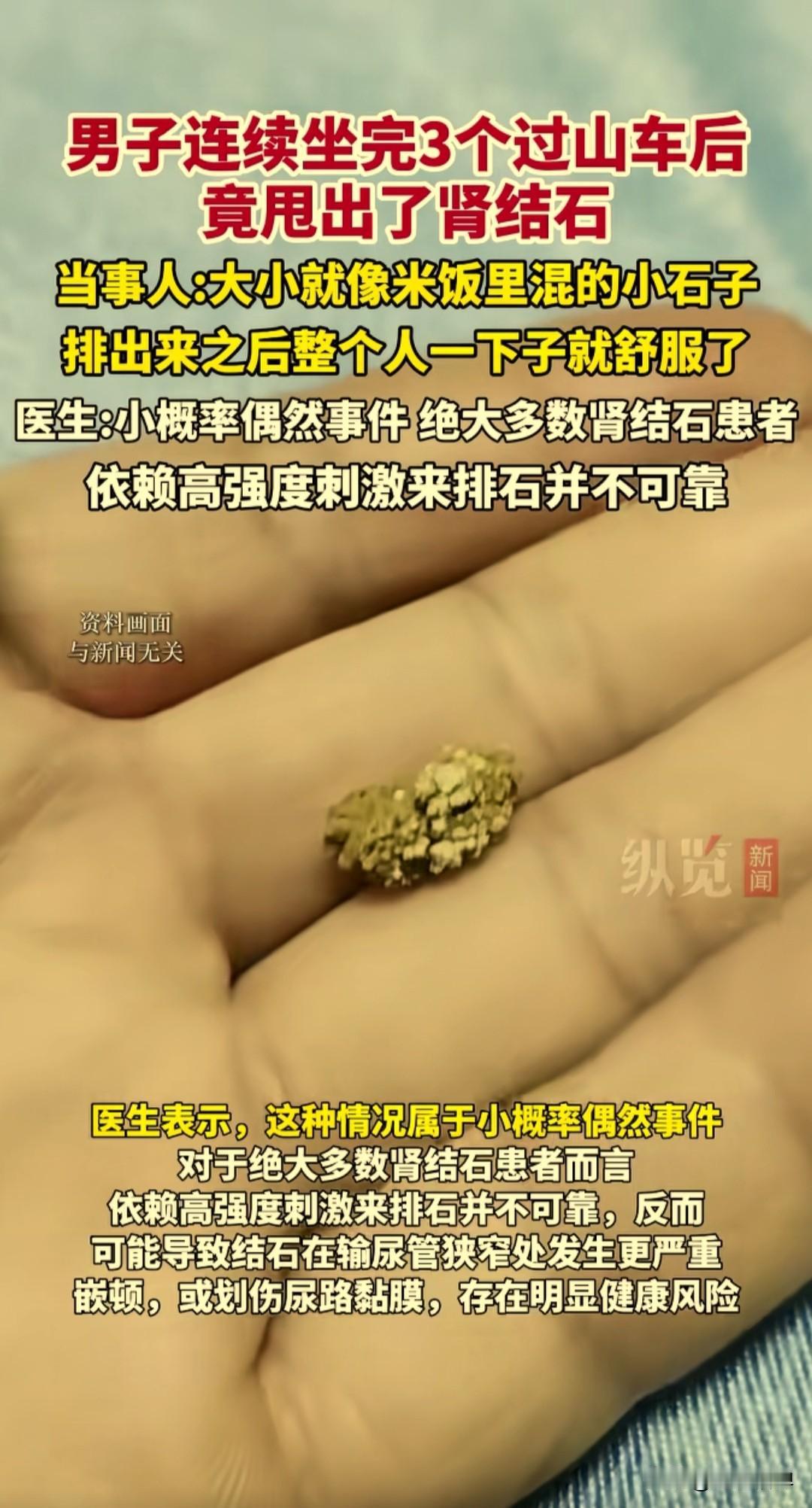 男子连续坐了三个过山车，竟然甩出肾结石，当事人：排出来整个人一下舒服多了。王