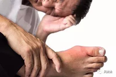 痛风排第二, 它排第一! 学会控制饮食, 这两种代谢病都能预防!