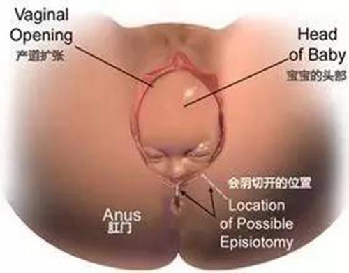 胎儿的脑袋那么大, 是如何从那么小的通道出来的? 母爱真伟大!