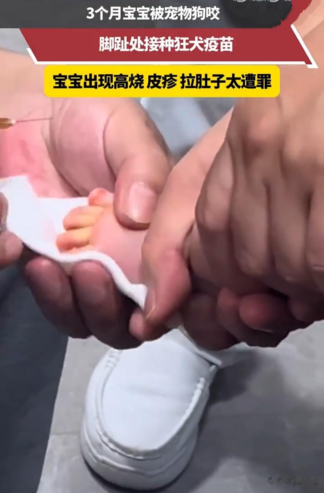 揪心啊，三个月大的宝宝在喝奶时，家中的宠物狗突然跑过来，对着宝宝的脚趾咬了一口。