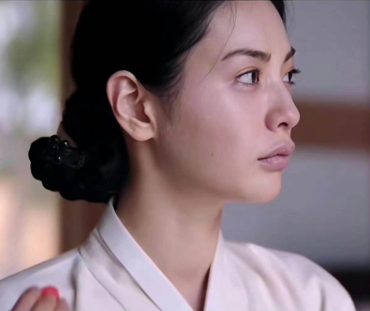 林珍娜整商林珍娜之前的牙齿咬合就已经很完美了，现在动了之后反而显得鼻子高度不够