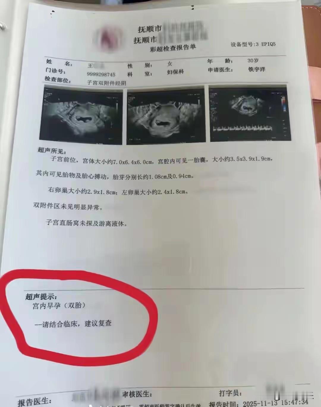 辽宁孕妈产检开盲盒，俩月从1胎变4胎！谁能想到！辽宁一位孕妈产检跟拆盲盒似