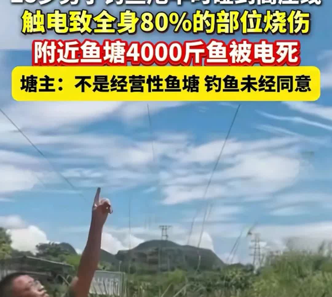 关于广西桂林男子，在高压线下钓鱼导致全身80%烧伤的事件，我们需要引起重视。现代