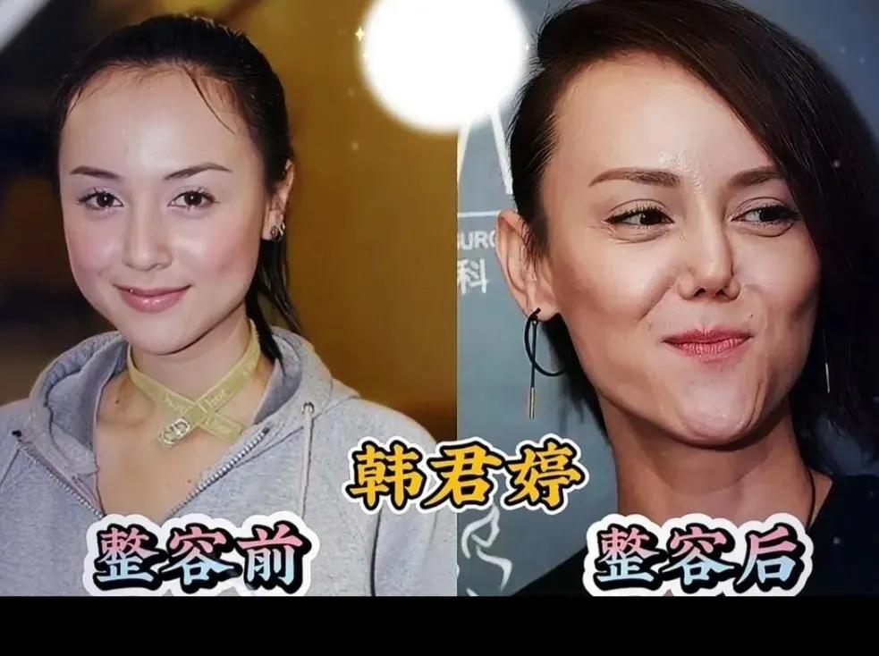 问大家一个扎心的问题，你说整容的人她后悔吗？看了很多的大明星和身边整过容的人，