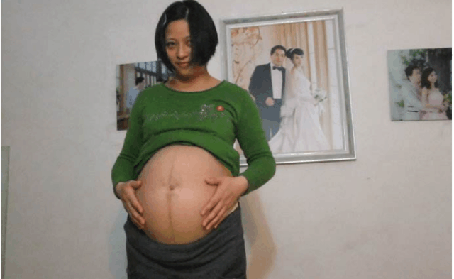 24岁孕妇逞能生3胞胎, 丈夫在手术室外红了眼眶