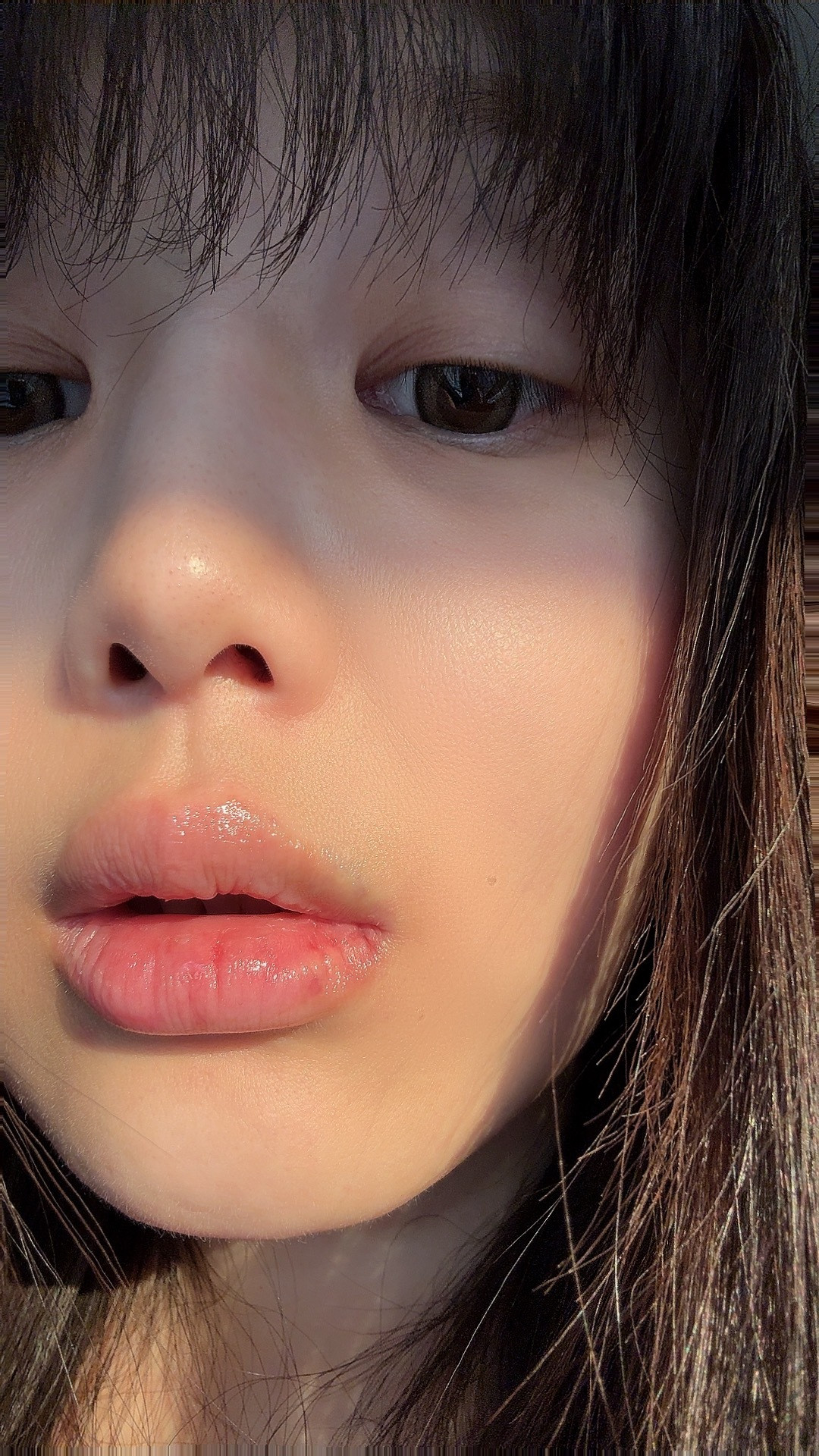 上次肿成卡戴珊还是在上次。可我今次明明谨遵医嘱并没有吃辣椒！（就只吃了一块麦当劳