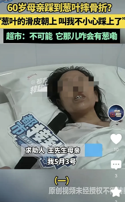 河南安阳，一60岁大妈逛超市，路过称重区那里滑了一跤，膝盖被摔得粉碎性骨折，到医