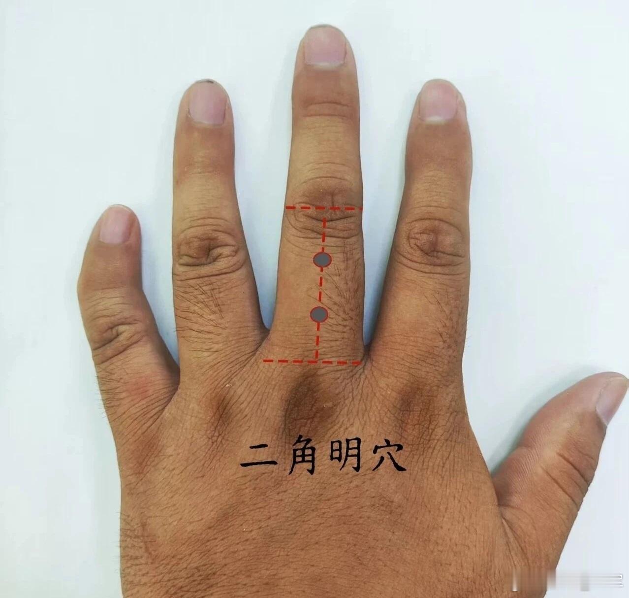 董氏奇穴应用案例：后脖颈疼一日中午，午睡起来以后后脖颈疼，就是后面左侧脖子大筋