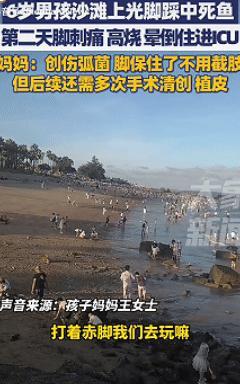 长见识了！福建厦门，6岁男孩在沙滩上光脚玩耍后莫名高烧呕吐，母亲以为是中暑，结果