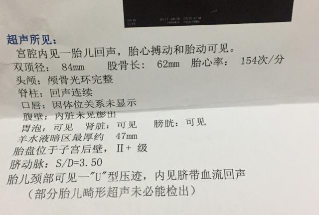 孕期以为是男孩, 已生小棉袄一枚, 想要的宝妈进来接吧