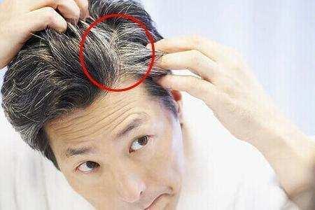 白发让你老十岁? 吃点来自山沟沟里的它, 白发慢慢黑回来