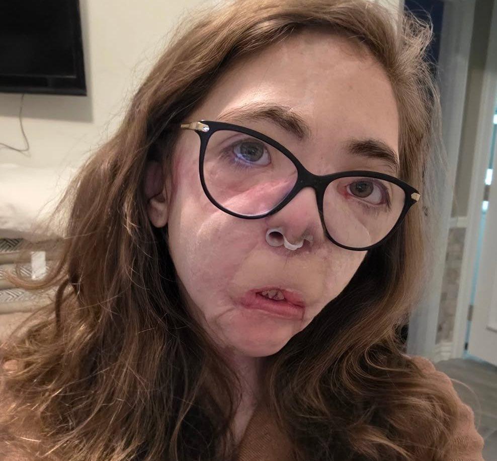 一位22岁的女大学生应朋友之邀出门遛狗。她刚打开门，两只凶猛的恶犬就对她展开了