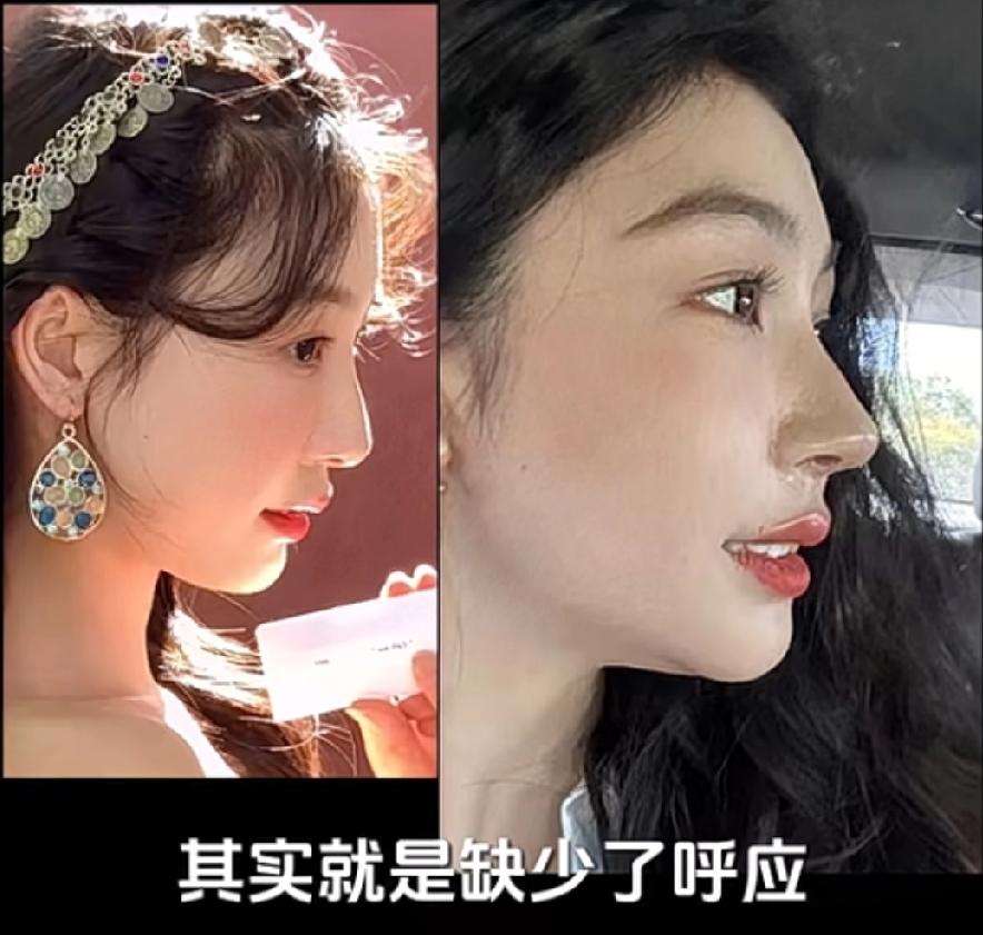 有博主讲易梦玲是第二个鞠婧祎，美商很高就是那种一步一步变美，你看不出来她具体