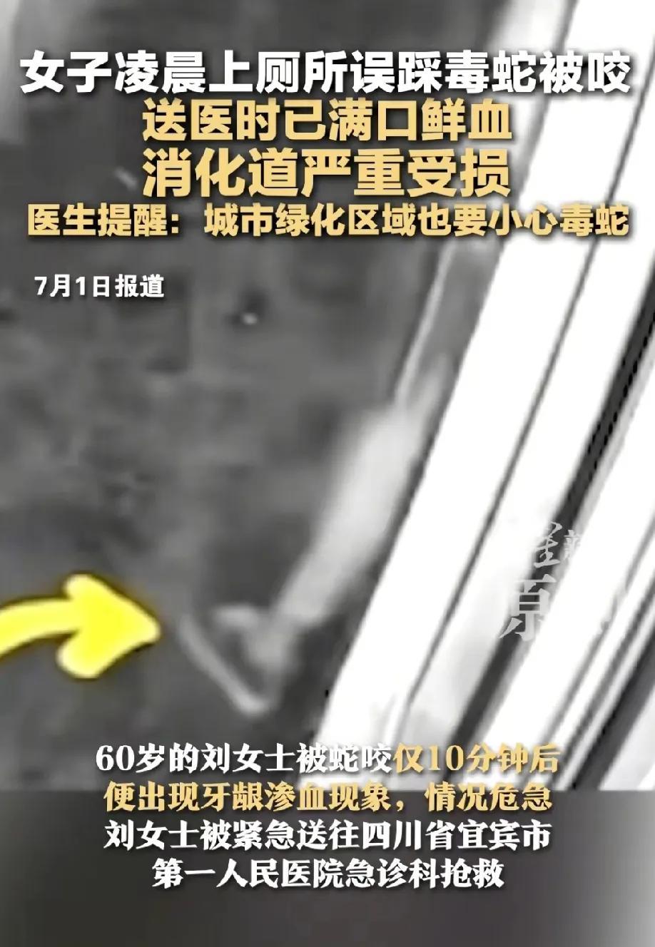 好吓人！云南女子凌晨2点半起来上厕所，刚上完厕所走出厕所门口，突然被一条毒蛇给咬