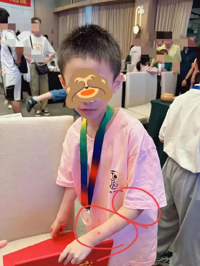 “以后要是不乖，我就揍你！”你以为是玩笑话，其实是小朱宏鑫的现实。看见了吗，带伤