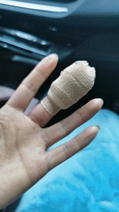 笑不活了！近日江苏南京，女子手受伤去医院缝了五针，手指被包扎了好几层，女子回到家