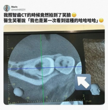 也是第一次看到这种的