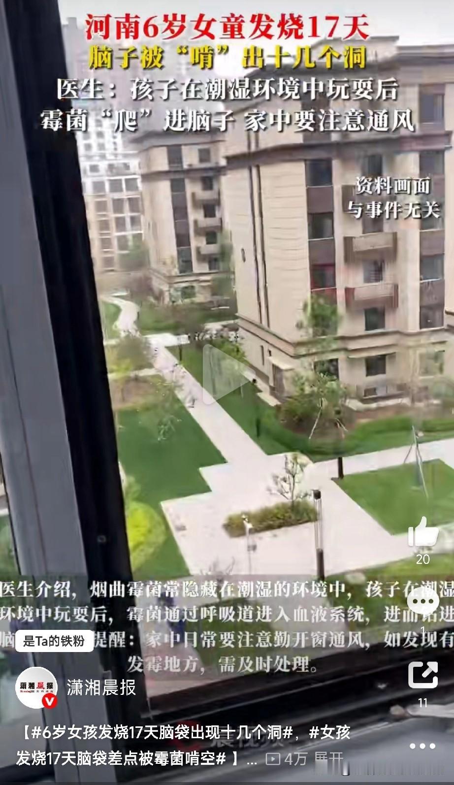 6岁女孩发烧17天脑袋出现十几个洞河南郑州的6岁女童高烧不退整整17天，家